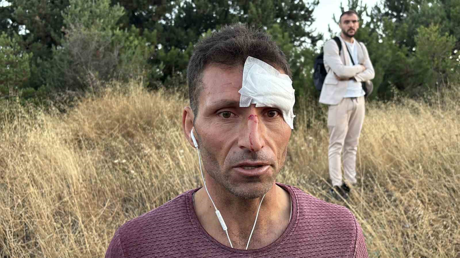 temde-yolcu-otobusu-ile-sogan-yuklu-kamyon-carpisti-1-olu-10-yarali
