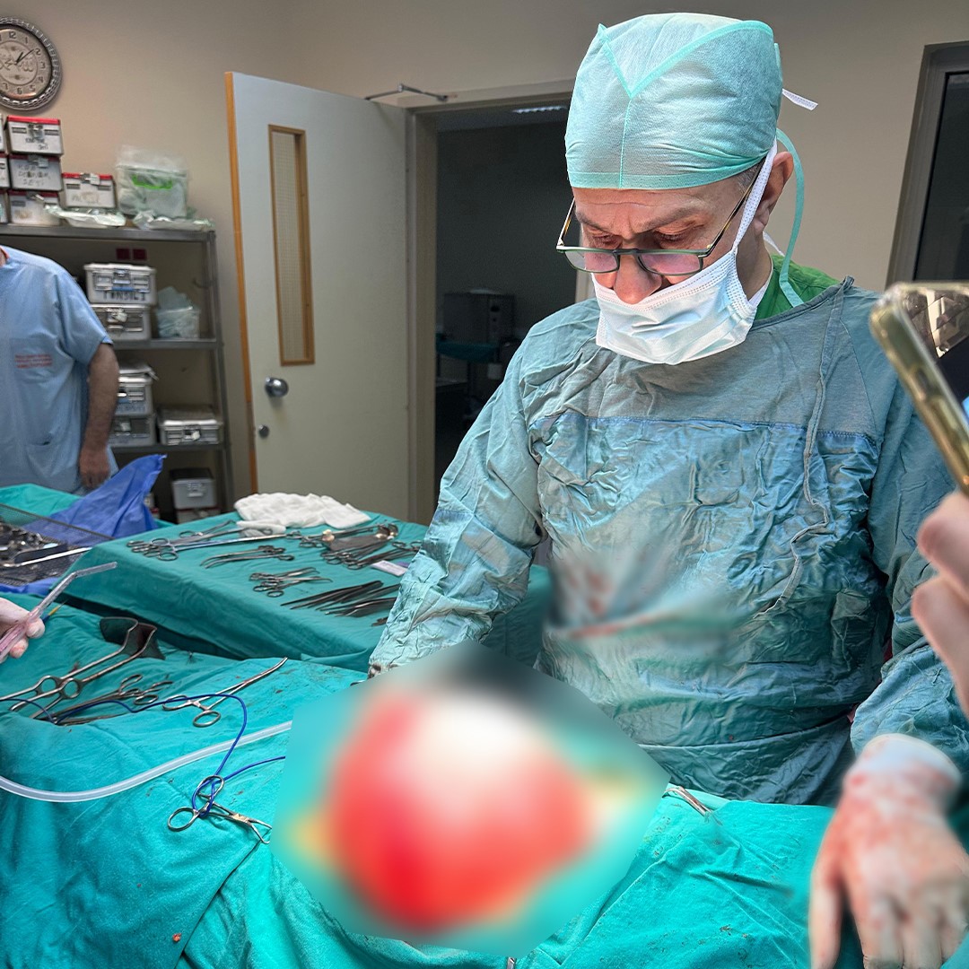 kilo-vermek-icin-hastaneye-giden-cocugun-karnindan-35-kiloluk-kist-cikti