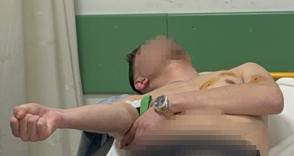 samsunda-pompali-tufekli-saldiri-2-yarali